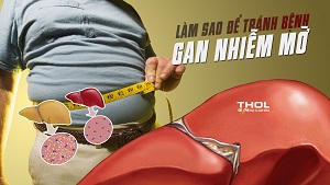 Bệnh Gan nhiễm mỡ - Nguyên nhân và cách phòng tránh - THOL