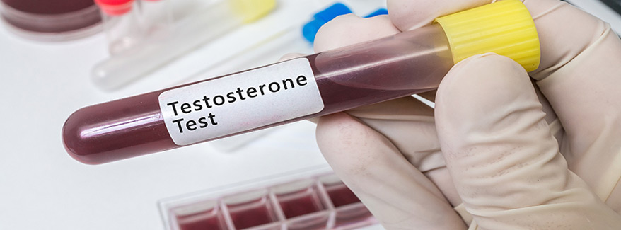 Kiểm tra testosterone trong máu gymer - THOL